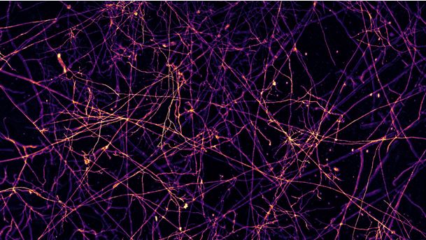 High-resolution mycelium network, dark pink and purple, rootlike structure, black background